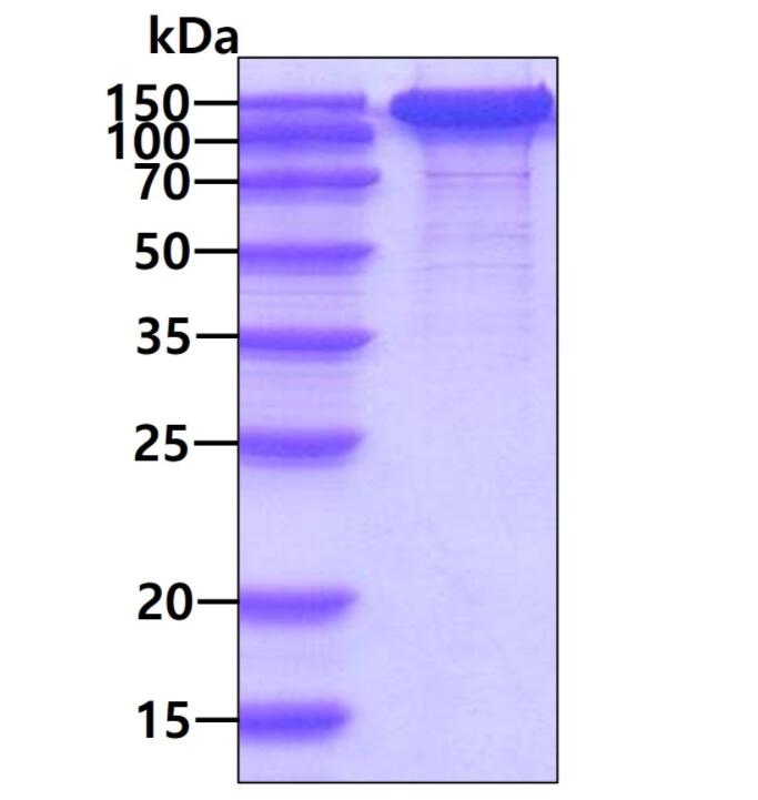 3 μg by SDS-PAGE under reducing condition and visualized by coomassie blue stain